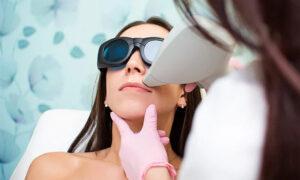 لیزر موهای ریز