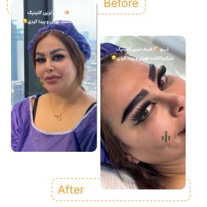 "هر تار ابرو، قدمی به سمت طبیعی‌ترین و جذاب‌ترین حالت ❤️"