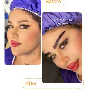 "معجزه میکروکاشت: ابروهای طبیعی، فرم عالی و جلوه‌ای شبیه لیفت ✨"