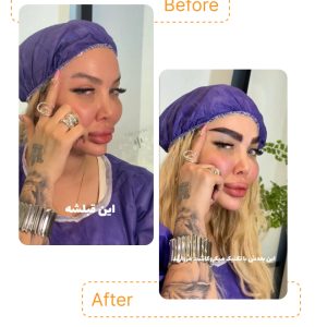 اینجا هر تار ابرو با ظرافت و دقت کاشته می‌شه تا نتیجه‌ای طبیعی و نچرال داشته باشی، بدون نیاز به آرایش روزانه