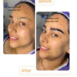 "ابروهای خوش‌فرم و طبیعی، بدون دردسر، فقط در کلینیک مروارید ✨"