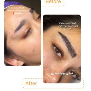 با مروارید می‌توان ابروهایی طبیعی، مرتب و جذاب داشت، بدون دردسر یا نیاز به آرایش اضافی.